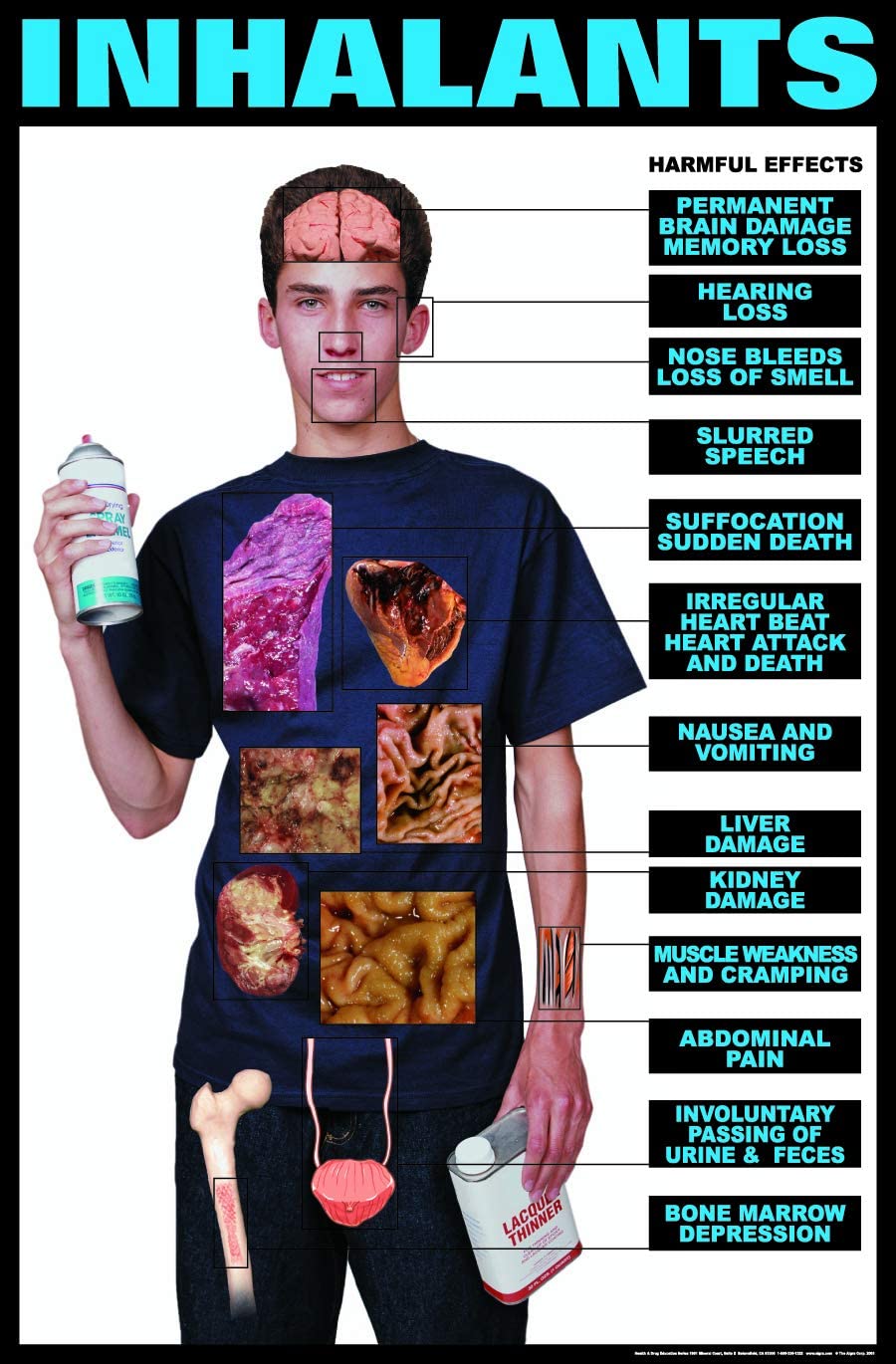 Inhalants Addiction. Harmful drugs. Harmful Effects перевод.